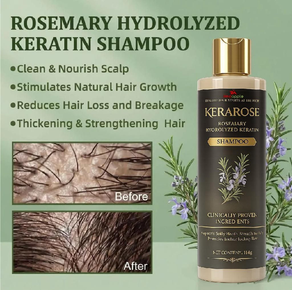 KeraRose Growth Elixir Shampoo – 114g (Pack of 2)